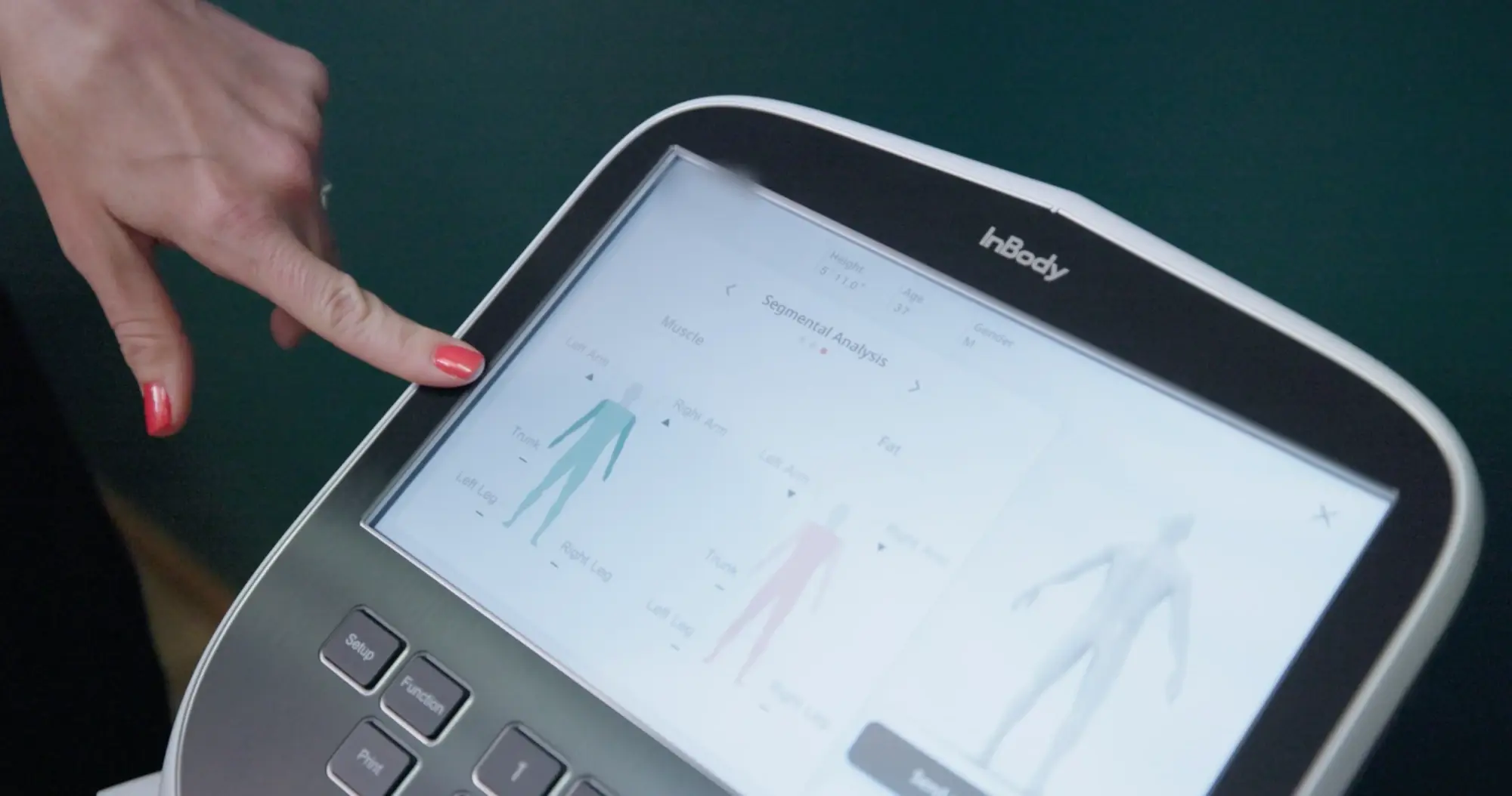 A body composition read-out showing muscle and fat broken down limb by limb